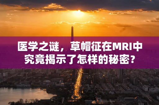 医学之谜，草帽征在MRI中究竟揭示了怎样的秘密？